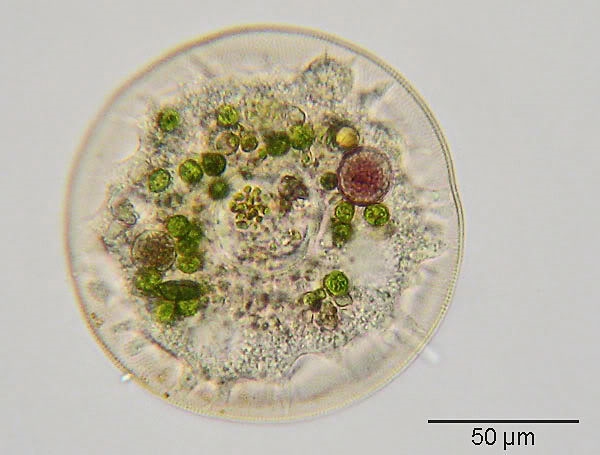 Arcella sp. aus alter Teichwasserprobe