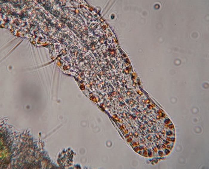 Aeolosoma sp, NO Ungarn, 07.2010