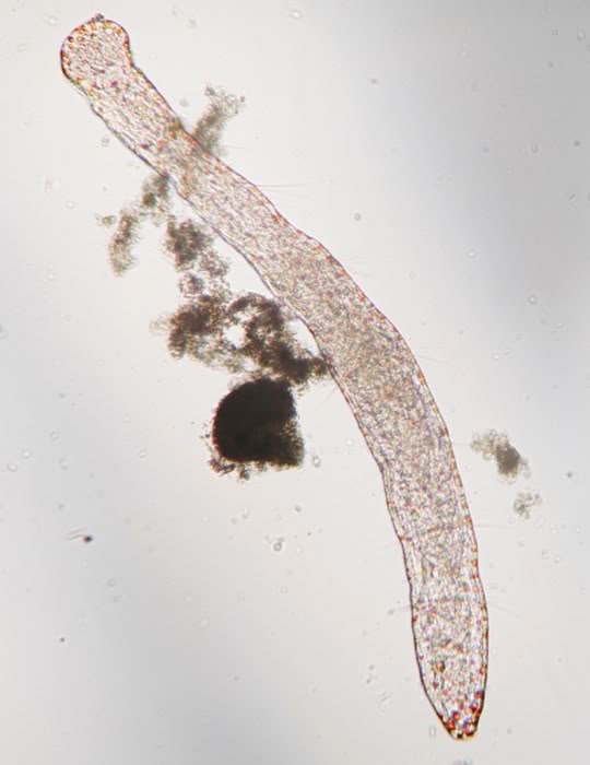 Aeolosoma sp, NO Ungarn, 07.2010