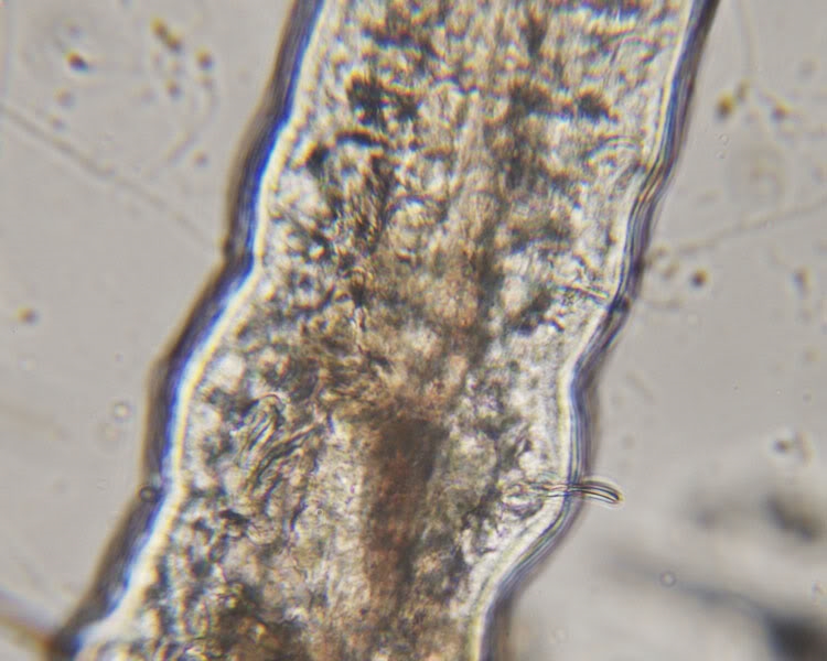 Naididae, OUngarn, 112010