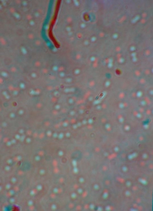 Artefakte in Mikrofotos