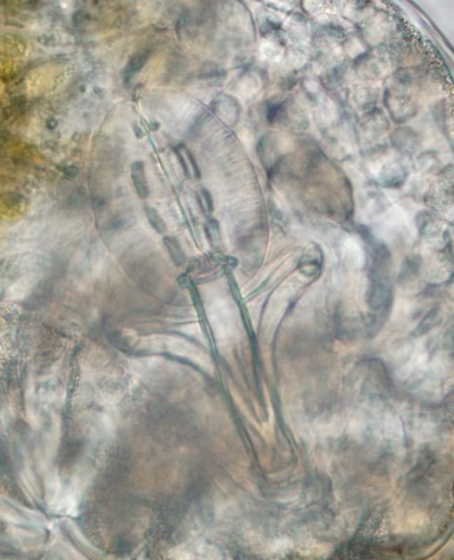 Macrobiotus sp, Tardigarada, OUngarn, 12.2010