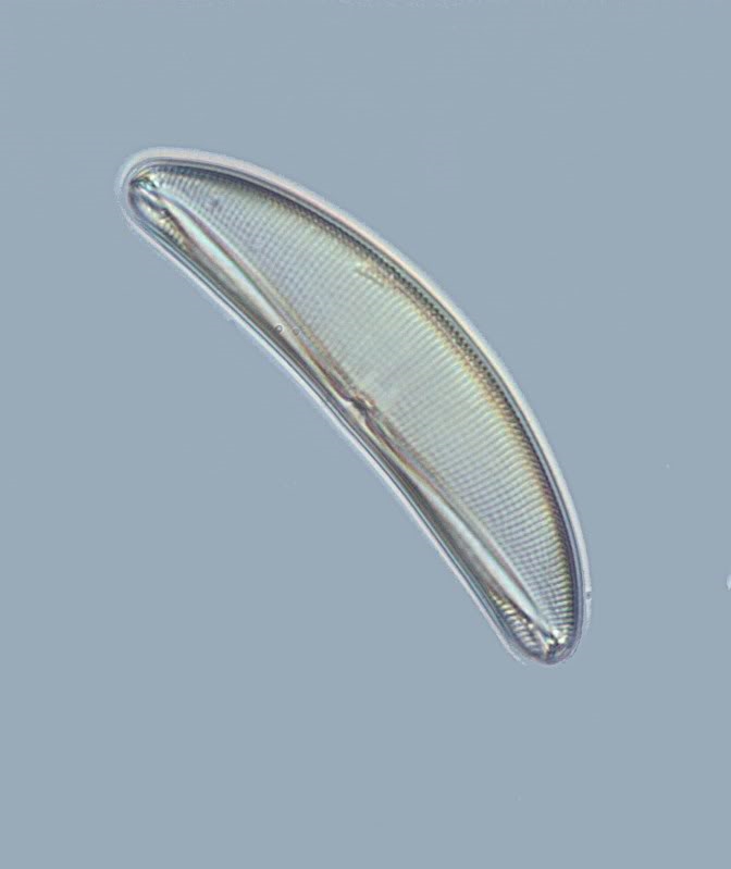 Diatomeen aus Florida, wer kann helfen?