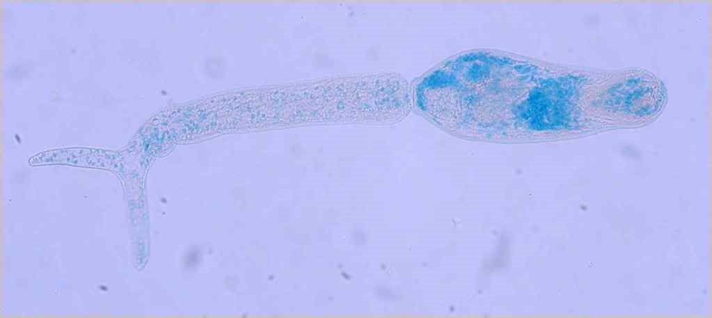 Zerkarien Trichobilharzia ocellata