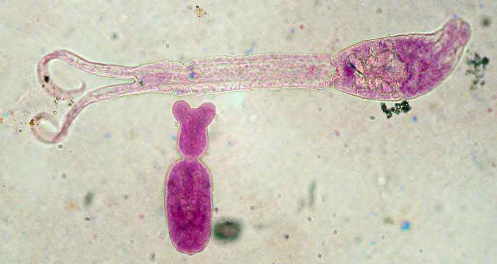 Zerkarien Trichobilharzia ocellata