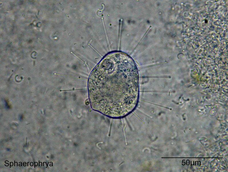 Suctoria Sphaerophrya