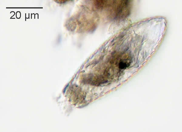 Testacea aus dem Moor