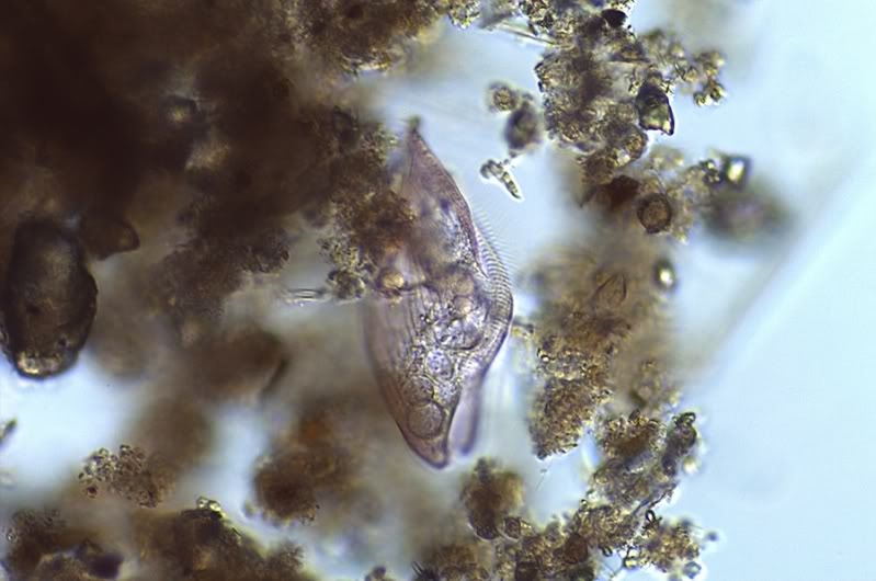 Zwei Ciliaten = Blepharisma musculus, Loxophyllum urticulariae