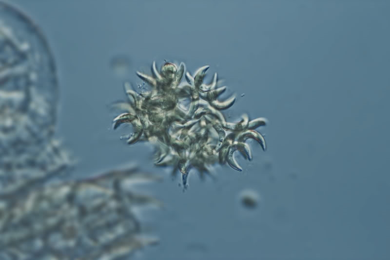 Kirchneriella?