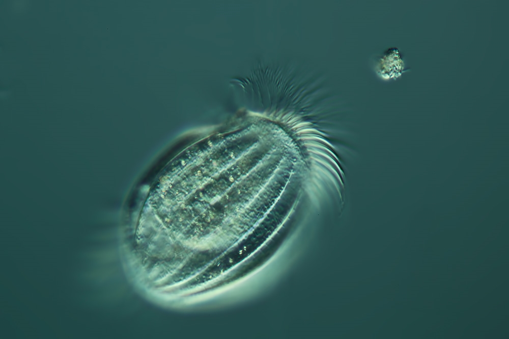 Euplotes ein kleines Porträt