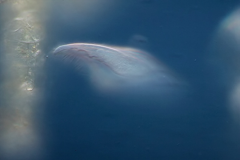 Purpurnes Wimperntierchen Blepharisma musculus