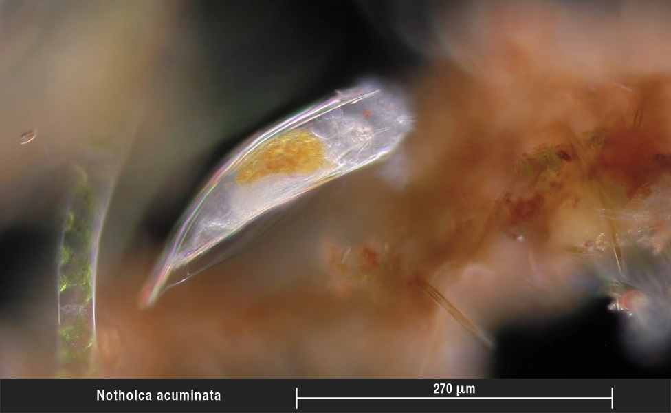 Das Rädertier Notholca acuminata (?)