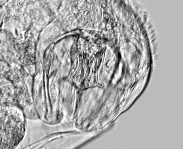 Rädertier Dicranophorus