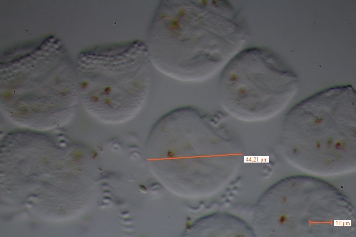 Vorticella monilata?