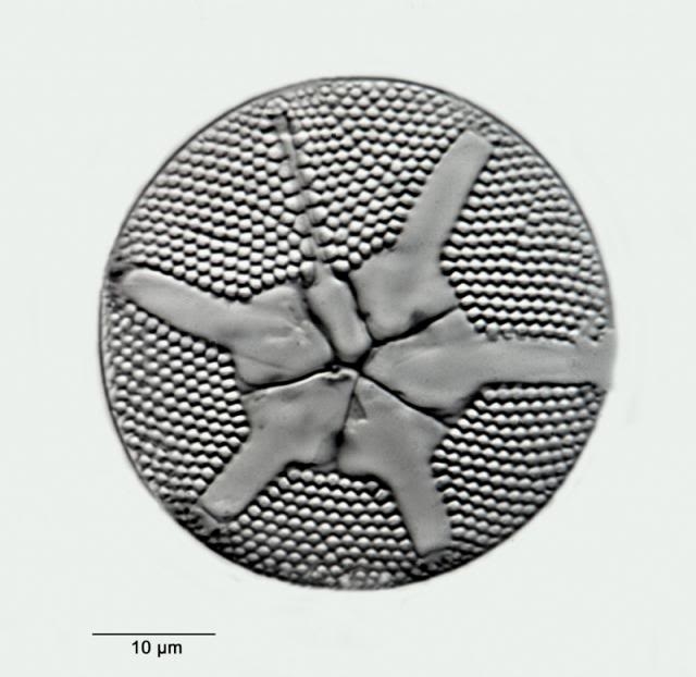 Asteromphalus brookei Bailey