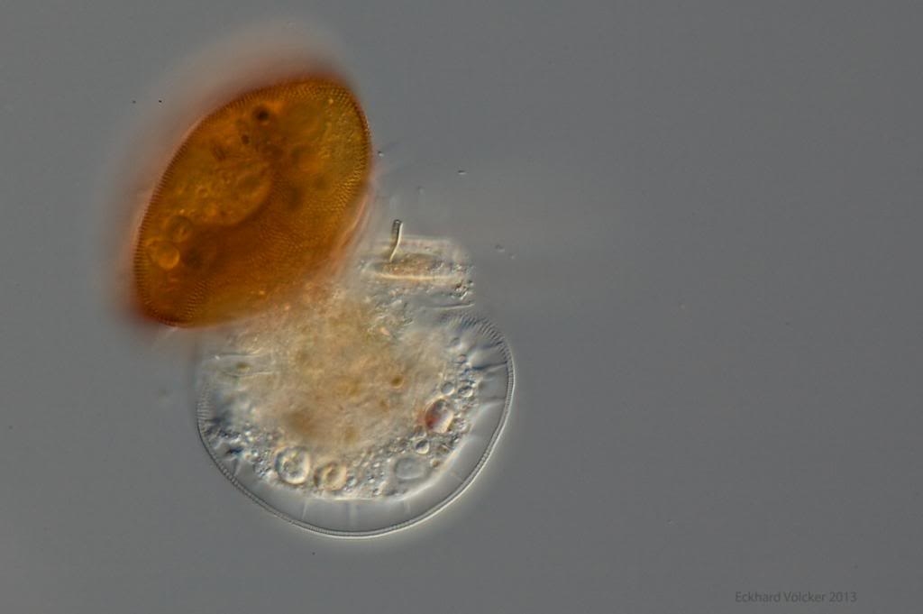Arcella und Lecythium