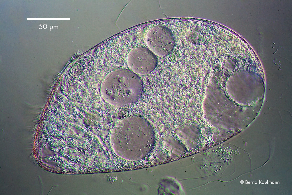 Das Lidtierchen Blepharisma americana