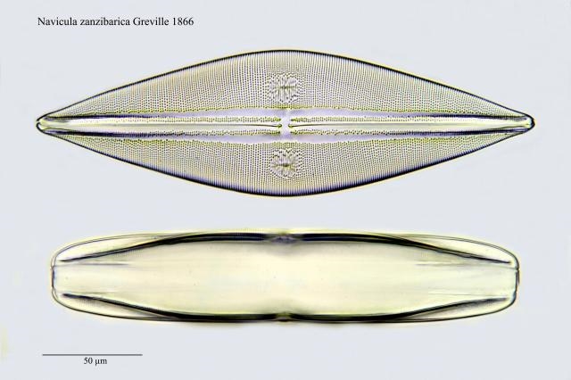 Noch 2 seltene DiatomeenPräparate mit Hauptseite+Gürtelseite