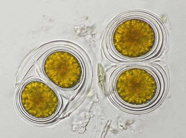 Gloeodinium montanum (Klasse Dinophyceae), syn. Hemidinium nasutum?