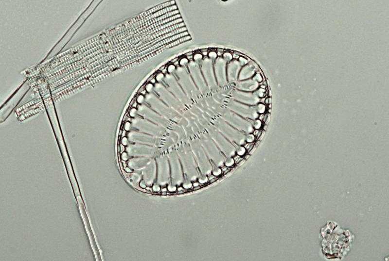 Diatomee aus der Adria