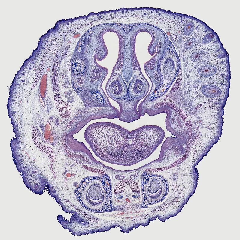 HISTOLOGIE: Nasenhöhle mit Flimmerzellen und Zilien