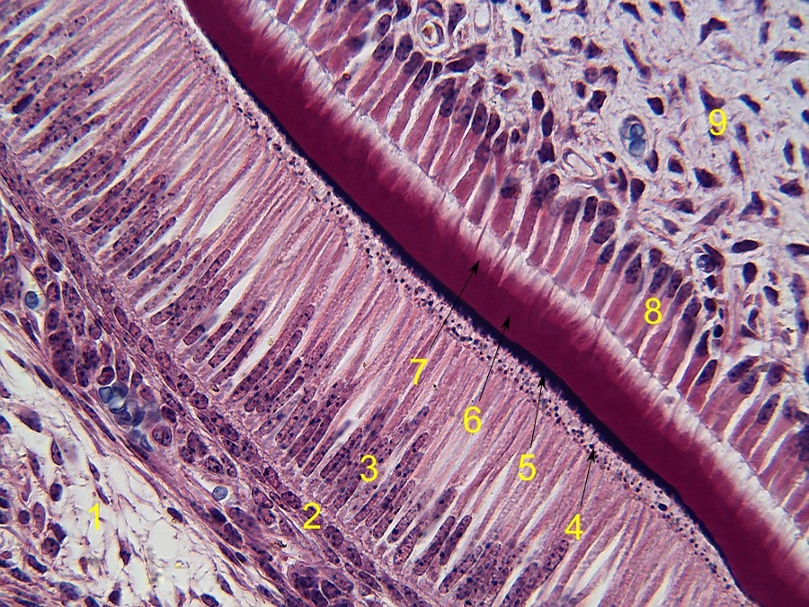 HISTOLOGIE Zahnbildung, Ameloblasten, Odontoblasten, Dentin und Schmelz.