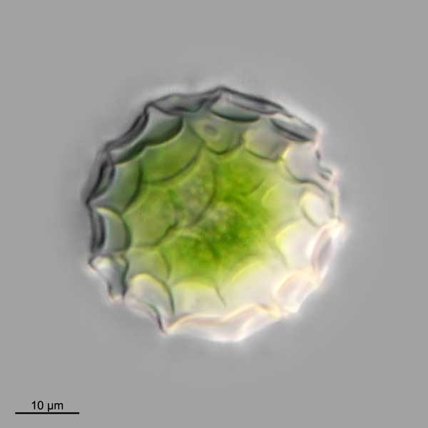 Chlamydomonas Zygosporen