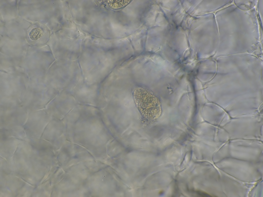 Actinosphaerium