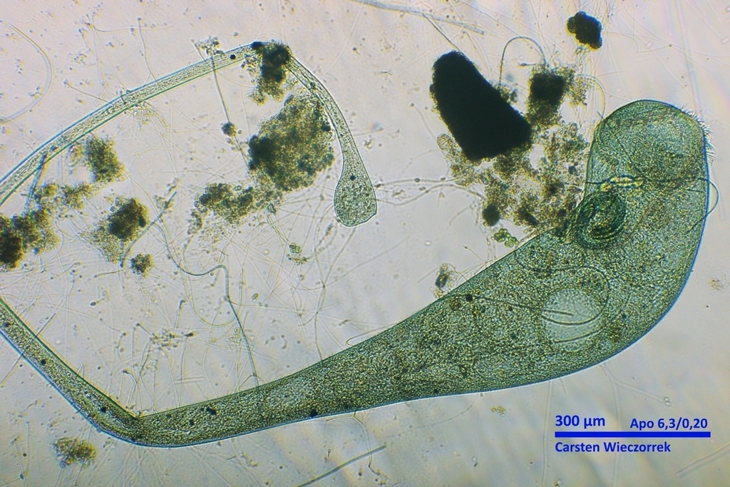 Nochmal Stentor coeruleus