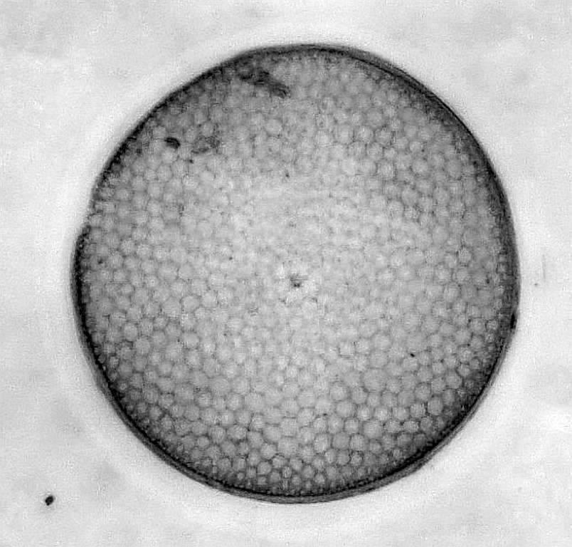 Oamaru Diatomeen Hilfe bei der Bestimmung gesucht