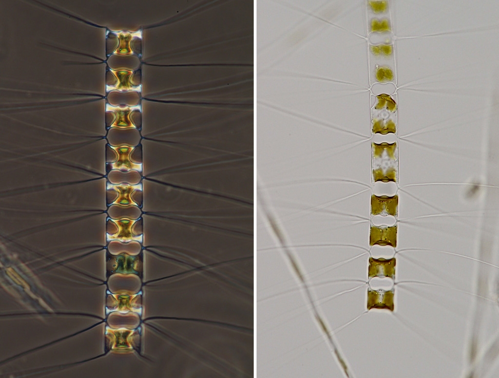 (lebende) Diatomeen und Dinoflagellat aus winterlichem OstseePlankton