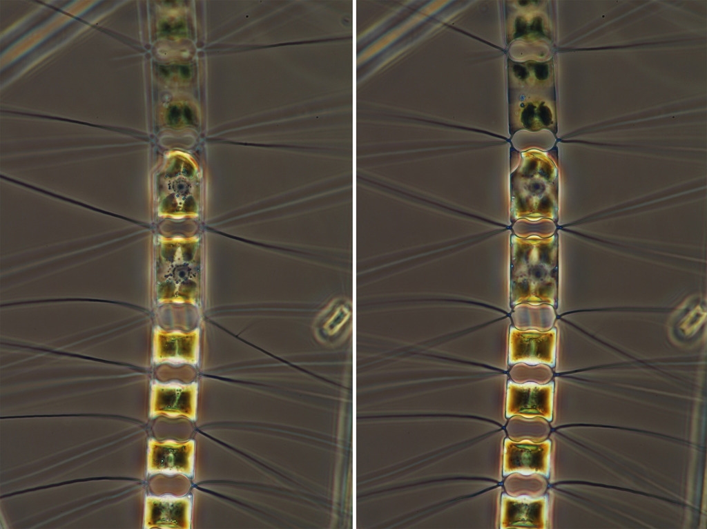 (lebende) Diatomeen und Dinoflagellat aus winterlichem OstseePlankton