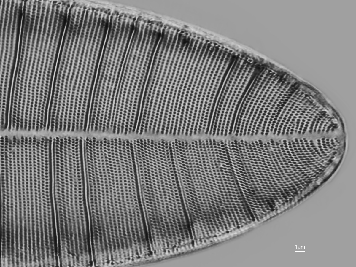 Diatomeen Detail, Diskussion Auflösung, Einbettung, IOR Seite 4