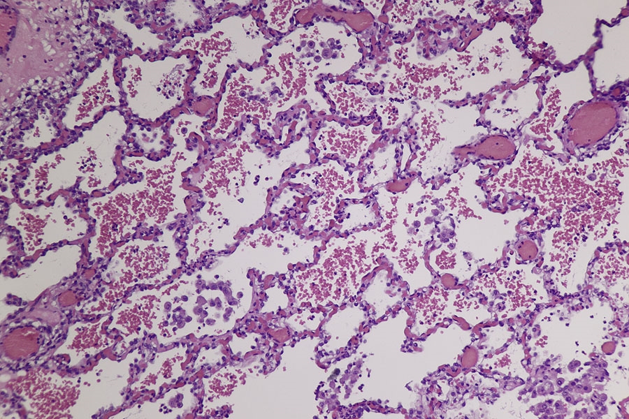 Echinococcus Granulosus Der Hundebandwurm