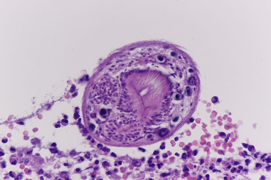Echinococcus Granulosus Der Hundebandwurm