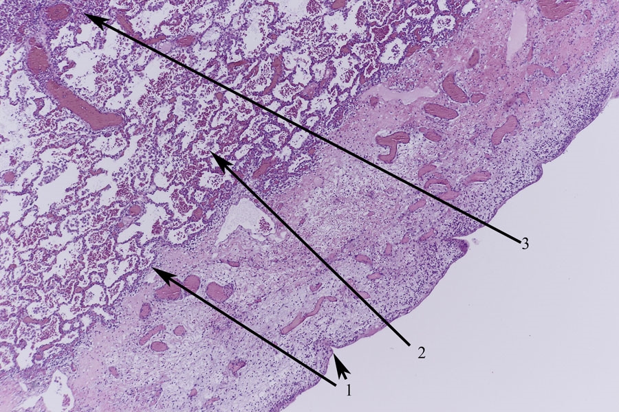 Echinococcus Granulosus Der Hundebandwurm