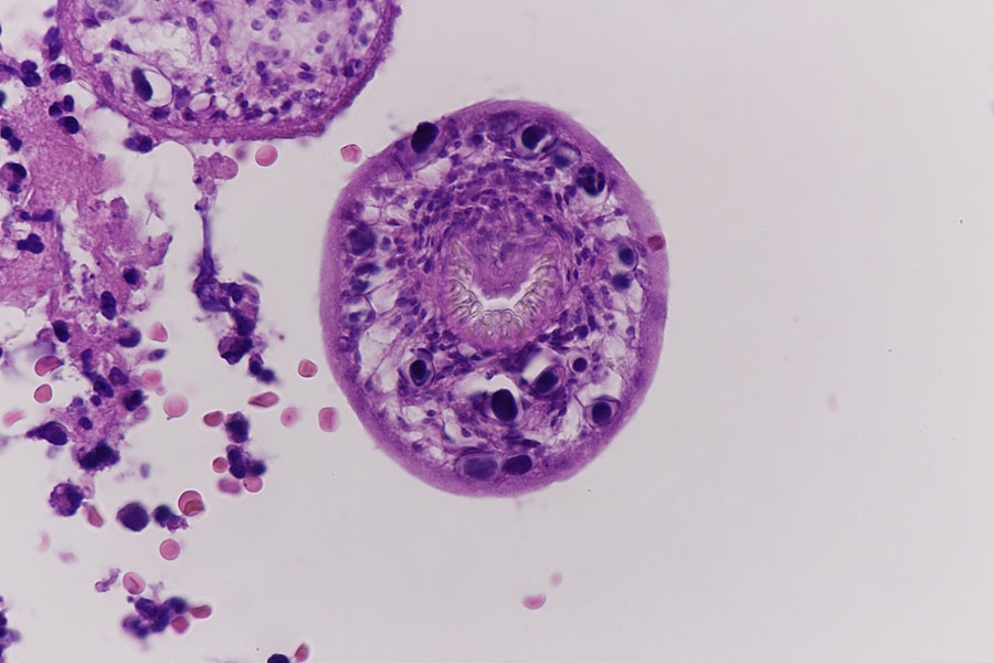 Echinococcus Granulosus Der Hundebandwurm