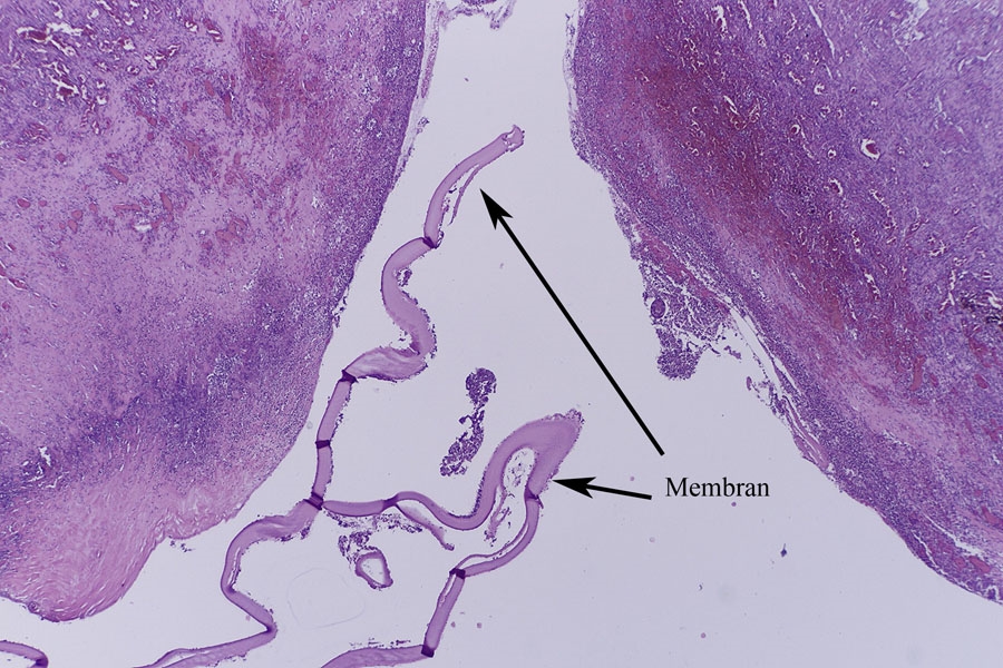 Echinococcus Granulosus Der Hundebandwurm