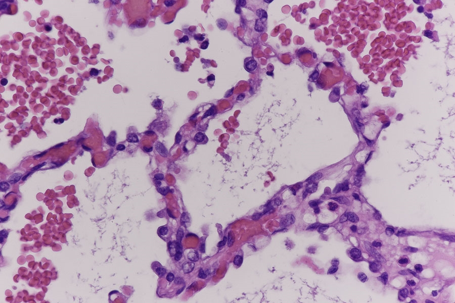 Echinococcus Granulosus Der Hundebandwurm