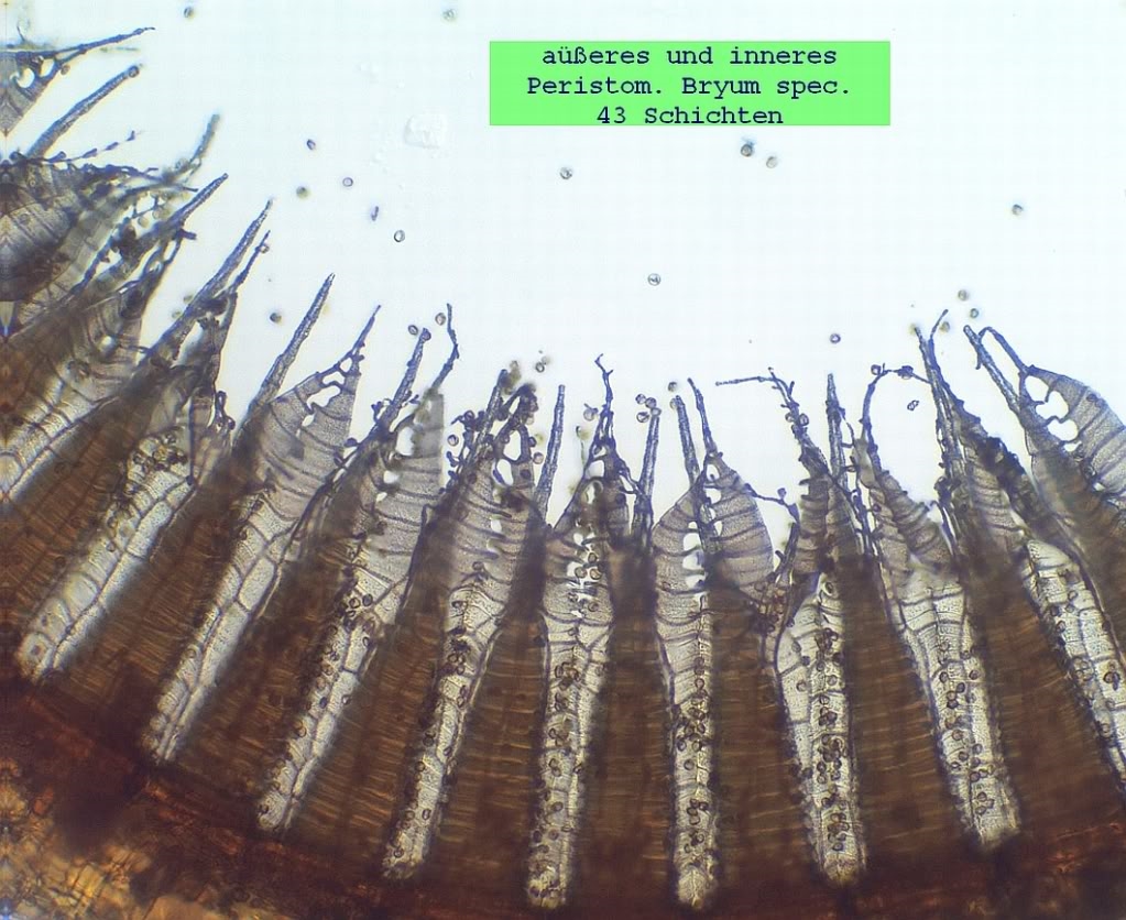 Peristom von Bryum cf. caespiticium