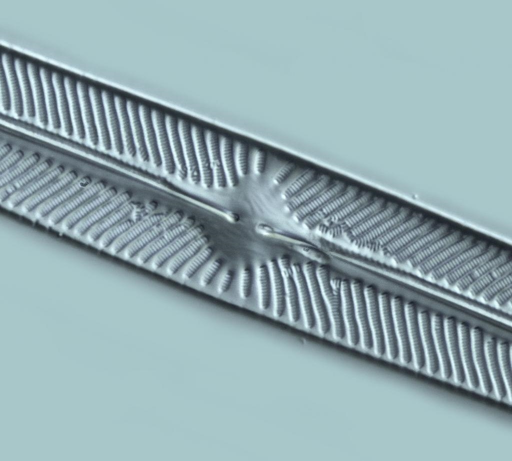 Diatomeen im 100er DIC