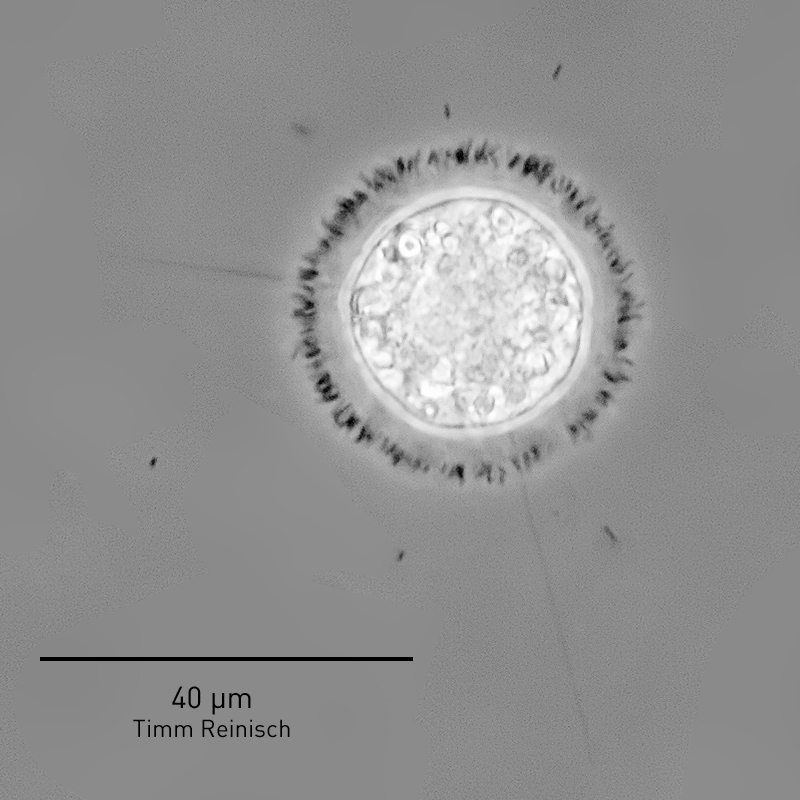 Heliozoa > Nuclearia Art