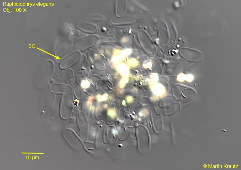 Raphidiophrys elegans