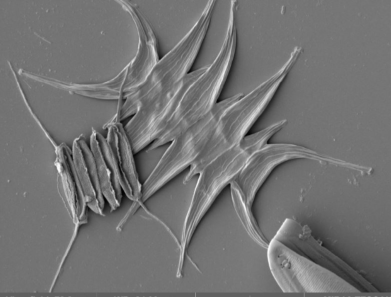 REM Test Plasmaätzen nativer Diatomeen