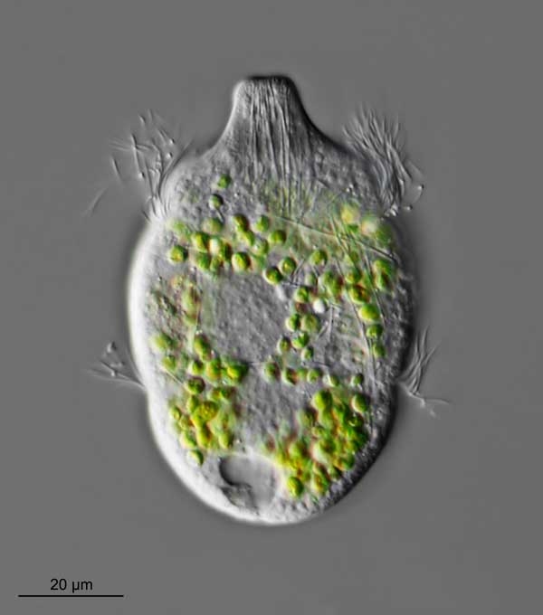 Didinium nasutum und D. balbianii