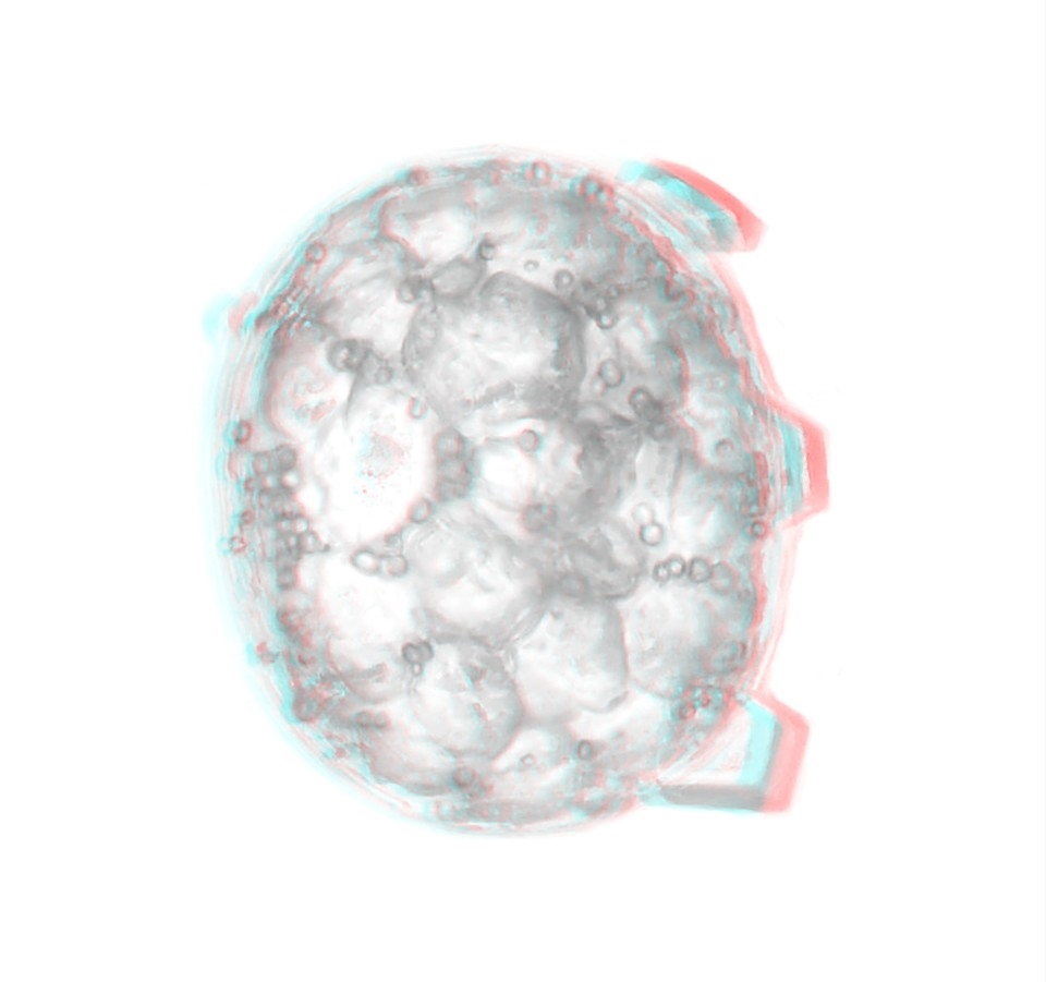 Bakterie? > Achromatium oxaliferum