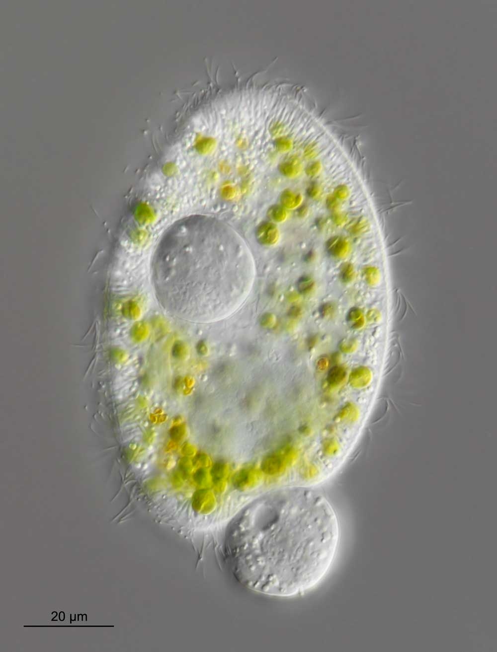 Das parasitische Sauginfusor Sphaerophrya parameciorum