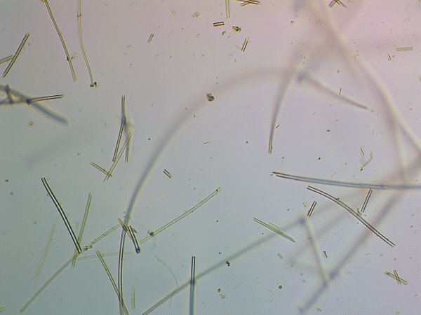 Leptothrix ochracea