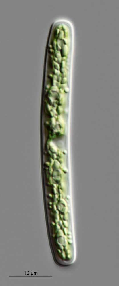 Jochalgen Roya obtusa und Spirotaenia erythrocephala