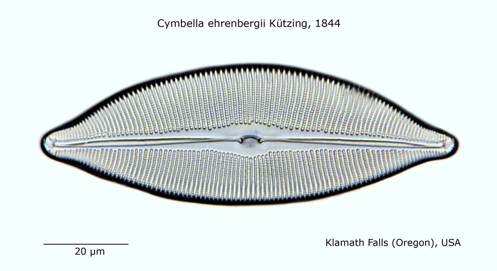 Diatomeen von Helmut Ullrich XIII
